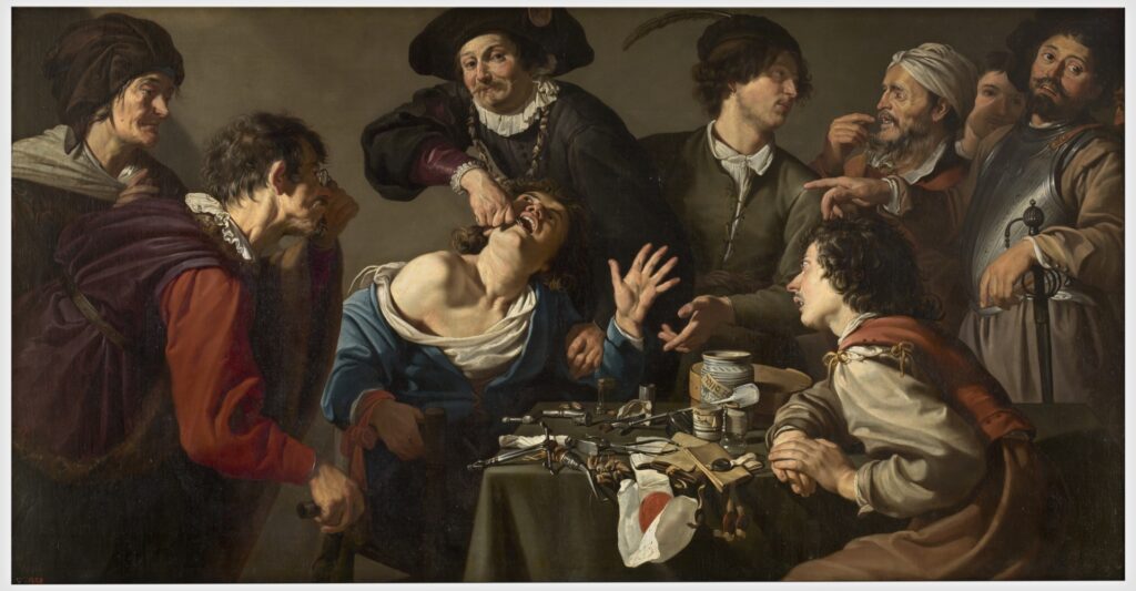 Theodoor Rombouts, The Tooth-Puller, 1620 – 1625 Oil on canvas, 87.8 x 46.5 in Prado Museum, Madrid